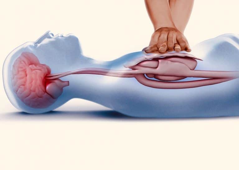 การทำ CPR วิธีปฐมพยาบาลที่เพิ่มโอกาสรอดชีวิต