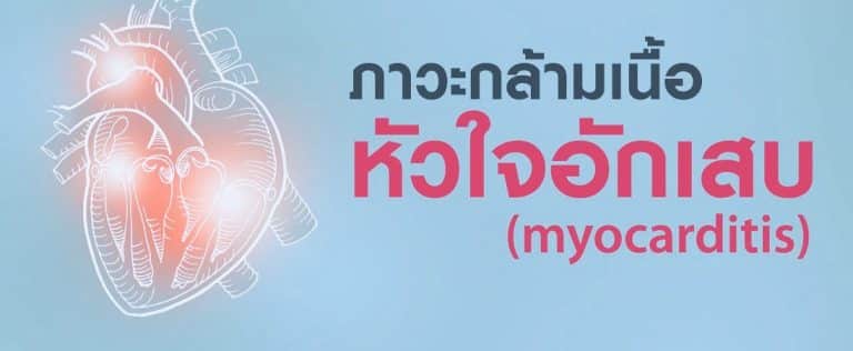 กล้ามเนื้อหัวใจอักเสบ (Myocarditis)