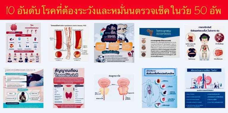 10 อันดับโรคที่ต้องระวังและหมั่นนตรวจเช็คในวัย 50 อัพ