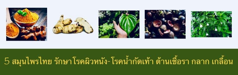 5 สมุนไพรไทย รักษาโรคผิวหนัง-โรคน้ำกัดเท้า ต้านเชื้อรา กลาก เกลื้อน