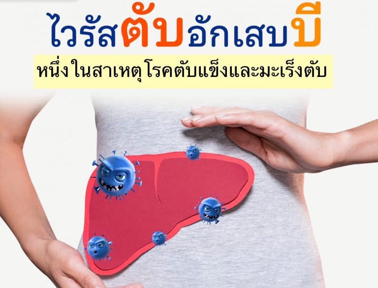 ไวรัสตับอักเสบบี หนึ่งในสาเหตุโรคตับแข็ง และมะเร็งตับ
