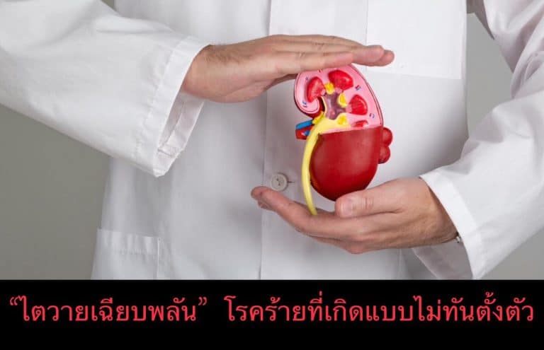 “ไตวายเฉียบพลัน” โรคร้ายที่เกิดแบบไม่ทันตั้งตัว