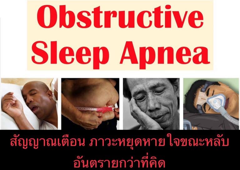สัญญาณเตือน ภาวะหยุดหายใจขณะหลับ อันตรายกว่าที่คิด