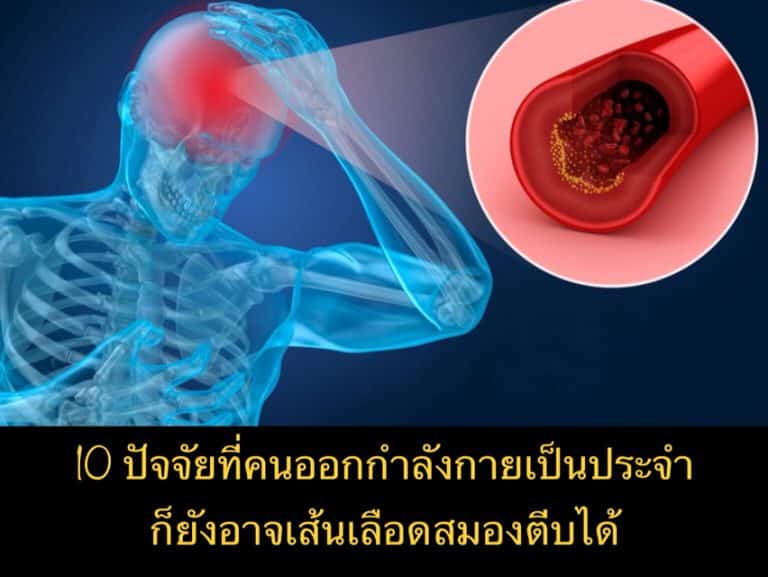 10 ปัจจัยที่คนออกกำลังกายเป็นประจำ ก็ยังอาจเส้นเลือดสมองตีบได้