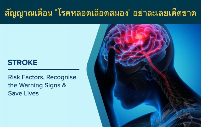สัญญาณเตือน “โรคหลอดเลือดสมอง” อย่าละเลยเด็ดขาด