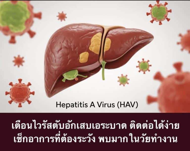 เตือนไวรัสตับอักเสบเอระบาด ติดต่อได้ง่าย เช็กอาการที่ต้องระวัง พบมากในวัยทำงาน