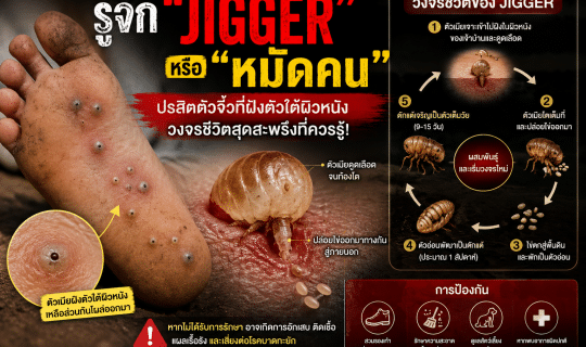 รู้จัก “Jigger” หรือ “หมัดคน” ปรสิตตัวจิ๋วที่ฝังตัวใต้ผิวหนัง วงจรชีวิตสุดสะพรึงที่ควรรู้