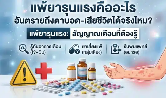 ภาพปกเชิงเตือนภัยสุขภาพเรื่องแพ้ยารุนแรง แสดงแผงยาและเม็ดยาหลากสีบนพื้นคลินิกสีขาว-ฟ้า พร้อมป้ายสามเหลี่ยมเตือนและกากบาทการแพทย์ และภาพประกอบแขนที่มีผื่นแดงเชิงสัญลักษณ์ พร้อมพาดหัวไทยและไอคอนอาการเตือน ไม่สื่อถึงบุคคลจริง